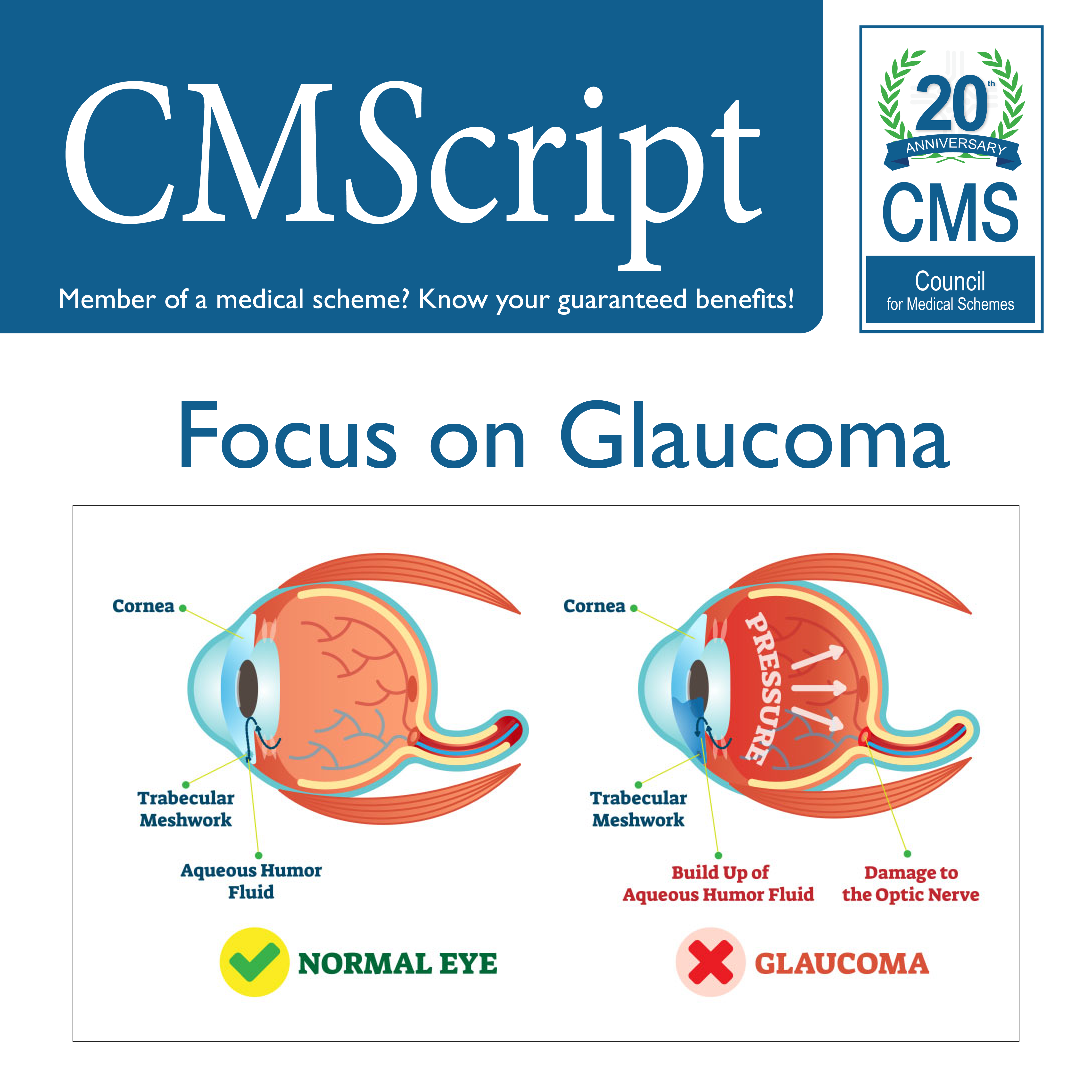 Glaucoma CMScript