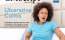 CMScript Ulcerative Colitis